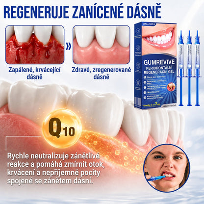 Vitalisys® GumRevive – 歯ぐきケア・リペアジェル 🌥️💪