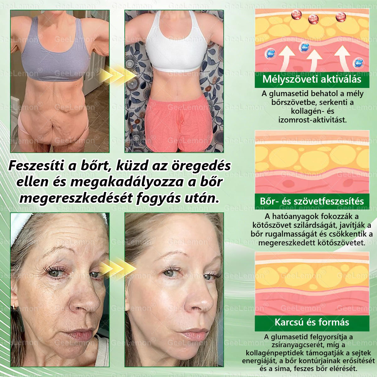 CE által regisztrált & GMP minősítésű | 𝐇𝒆𝒂𝐥𝐫𝐢𝐳𝐞® Glumasetide 8 az 1-ben Karcsú és Egészséges Nano Mikrotűs Tapasz 🇭🇺