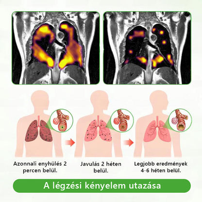 Magyar tulajdonban és üzemeltetésben ✅ Murwon® botanikus ökörfarkkóró (Mullein) tüdőtisztító diffúzor  (🫁 köhögés, garatgyulladás, légszomj, köpet, orrdugulás, hörghurut, hörghurut, allergiás tünetek, tüdő diszkomfort) 💞