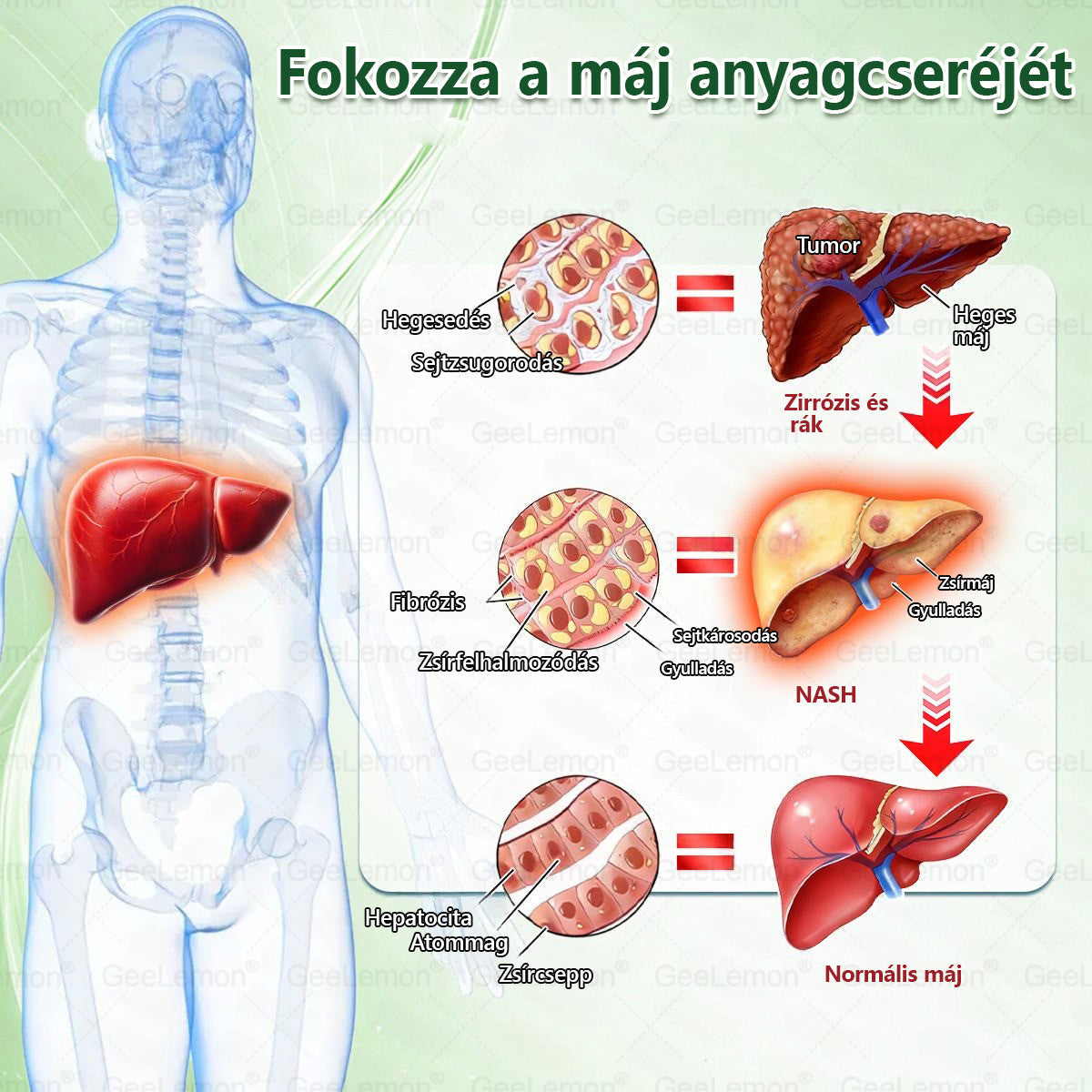 CE által regisztrált & GMP minősítésű | 𝐇𝒆𝒂𝐥𝐫𝐢𝐳𝐞® Glumasetide 8 az 1-ben Karcsú és Egészséges Nano Mikrotűs Tapasz 🇭🇺
