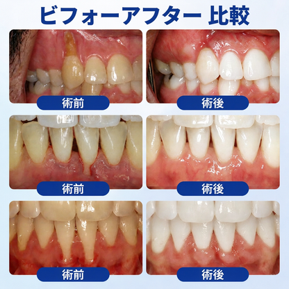 Vitalisys® GumRevive – 歯ぐきケア・リペアジェル 🌥️❤️