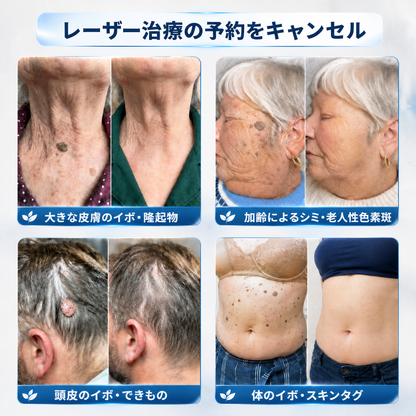 公式ブランドストア 🐉|⚾𝐕𝐢𝐭𝐚𝐥𝐢𝐬𝐲𝐬® 7日間 タグ＆スポットイレーサー（無痛・跡残りゼロのローラーボール）