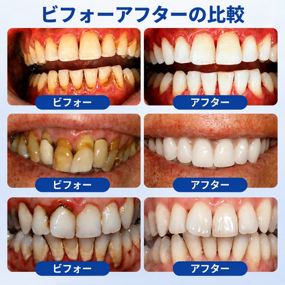 Vitalisys® GumRevive – 歯ぐきケア・リペアジェル 🌥️❤️