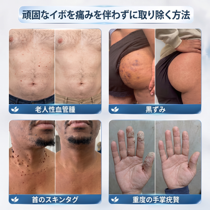 公式ブランドストア 🐉|⚾𝐕𝐢𝐭𝐚𝐥𝐢𝐬𝐲𝐬® 7日間 タグ＆スポットイレーサー（無痛・跡残りゼロのローラーボール）