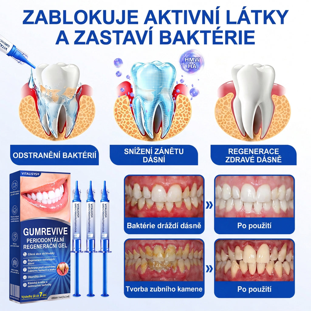 Vitalisys® GumRevive – 歯ぐきケア・リペアジェル 🌥️💪