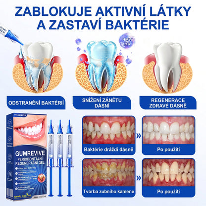 Vitalisys® GumRevive – 歯ぐきケア・リペアジェル 🌥️💪