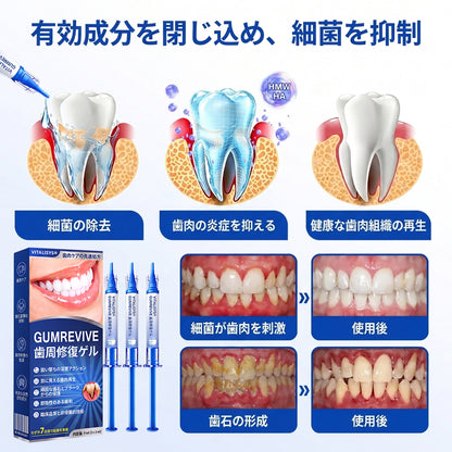 Vitalisys® GumRevive – 歯ぐきケア・リペアジェル 🌥️❤️