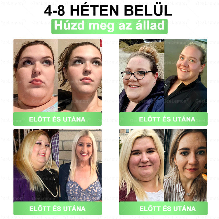 CE által regisztrált & GMP minősítésű | 𝐇𝒆𝒂𝐥𝐫𝐢𝐳𝐞® Glumasetide 8 az 1-ben Karcsú és Egészséges Nano Mikrotűs Tapasz 🇭🇺