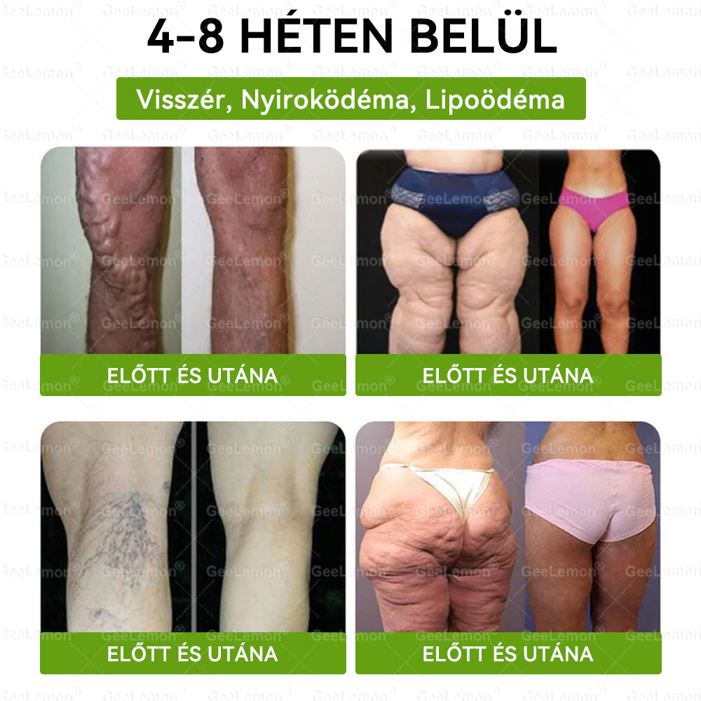 CE által regisztrált & GMP minősítésű | 𝐇𝒆𝒂𝐥𝐫𝐢𝐳𝐞® Glumasetide 8 az 1-ben Karcsú és Egészséges Nano Mikrotűs Tapasz 🇭🇺