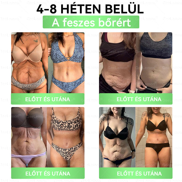 CE által regisztrált & GMP minősítésű | 𝐇𝒆𝒂𝐥𝐫𝐢𝐳𝐞® Glumasetide 8 az 1-ben Karcsú és Egészséges Nano Mikrotűs Tapasz 🇭🇺